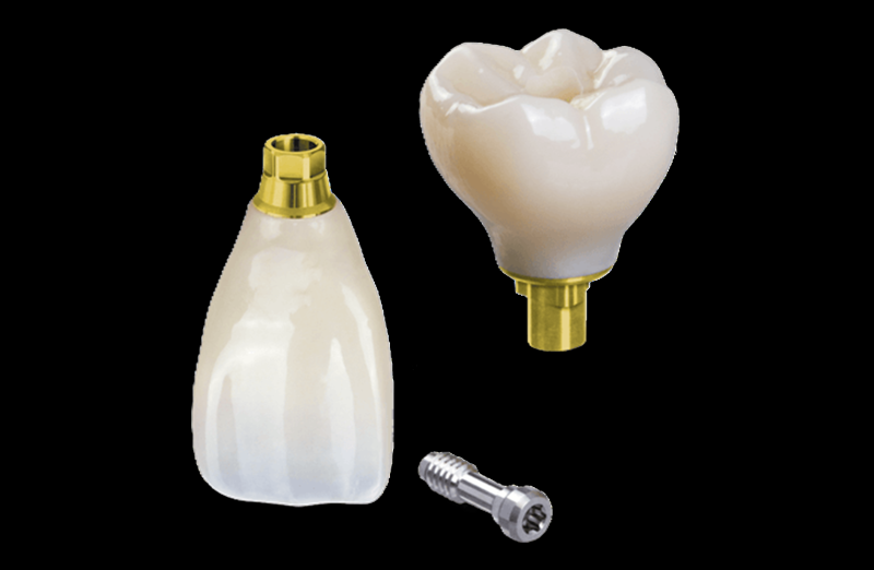 螺絲固定式牙冠/客製支台